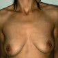 topless woman nude posing for picture with sagging breasts