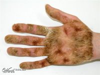 man hairy palms and hands from masturbating too much false myth